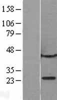 CBX1 Human Over-expression Lysate