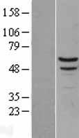 Myotilin (MYOT) Human Over-expression Lysate