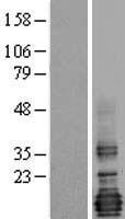 LMO4 Human Over-expression Lysate