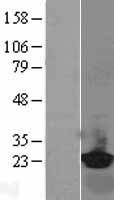 RBP4 Human Over-expression Lysate