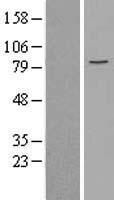 MCM5 Human Over-expression Lysate