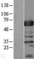 TRAFD1 Human Over-expression Lysate