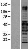 RPIP8 (RUNDC3A) Human Over-expression Lysate