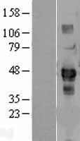 ENTR1 Human Over-expression Lysate