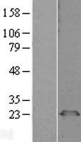 PGRMC1 Human Over-expression Lysate