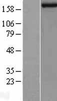 KDM5B Human Over-expression Lysate