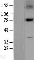 PLK2 Human Over-expression Lysate