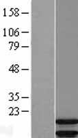 ARPP19 Human Over-expression Lysate