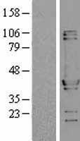 NUDC Human Over-expression Lysate