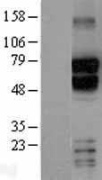 TBR1 Human Over-expression Lysate