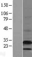 emopamil binding protein (EBP) Human Over-expression Lysate
