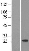 DCTN6 Human Over-expression Lysate