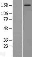 NCOA2 Human Over-expression Lysate