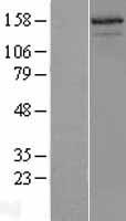 SRC3 (NCOA3) Human Over-expression Lysate