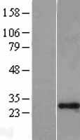 GAS41 (YEATS4) Human Over-expression Lysate