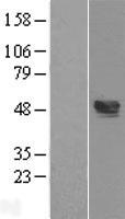 TXNIP Human Over-expression Lysate