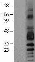 PDPN Human Over-expression Lysate
