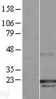 PRA1 (RABAC1) Human Over-expression Lysate