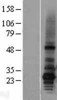 AGPAT2 Human Over-expression Lysate