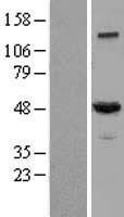 Dynamitin (DCTN2) Human Over-expression Lysate