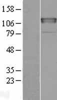 CHERP Human Over-expression Lysate