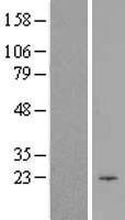 CIB1 Human Over-expression Lysate
