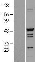 TADA3L (TADA3) Human Over-expression Lysate