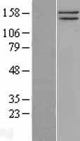 SMC1 (SMC1A) Human Over-expression Lysate