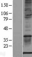 S100A1 Human Over-expression Lysate