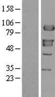 XRCC1 Human Over-expression Lysate
