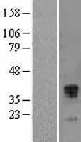 TFPI Human Over-expression Lysate