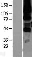 PKC eta (PRKCH) Human Over-expression Lysate