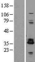 Enkephalin (PENK) Human Over-expression Lysate