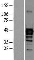 nkx6.1 (NKX6-1) Human Over-expression Lysate