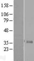 Neurogenin 1 (NEUROG1) Human Over-expression Lysate