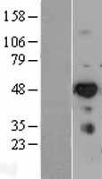 IRF6 Human Over-expression Lysate