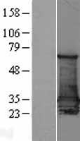 14-3-3 sigma (SFN) Human Over-expression Lysate