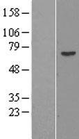 PRAME Human Over-expression Lysate