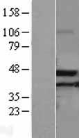 ACAA2 Human Over-expression Lysate