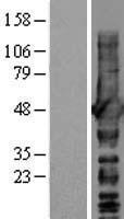 NDRG1 Human Over-expression Lysate