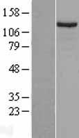 DLC1 Human Over-expression Lysate