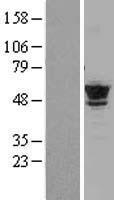 TUBB4B Human Over-expression Lysate