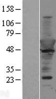 CPNE6 Human Over-expression Lysate