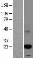 ARMET (MANF) Human Over-expression Lysate