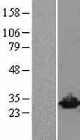 UCHL3 Human Over-expression Lysate