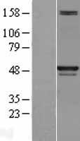 SKP2 Human Over-expression Lysate