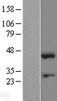 SOX1 Human Over-expression Lysate