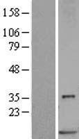 S100P Human Over-expression Lysate