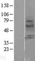 Melatonin Receptor 1A (MTNR1A) Human Over-expression Lysate