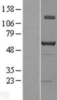 NAB1 Human Over-expression Lysate